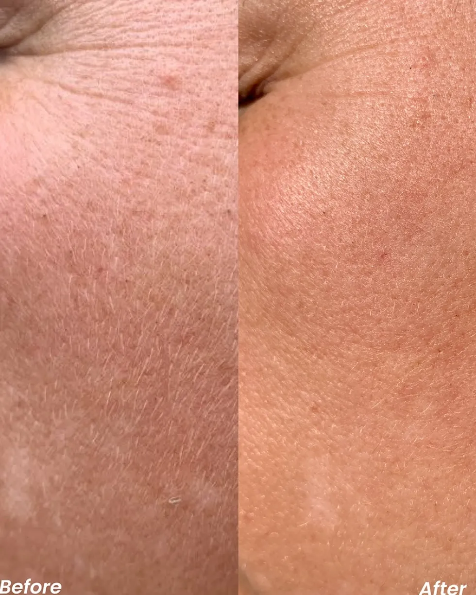 clay and glow retinol nacht serum Anti-aging Serum