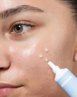 clay and glow spot treatment gel Gel