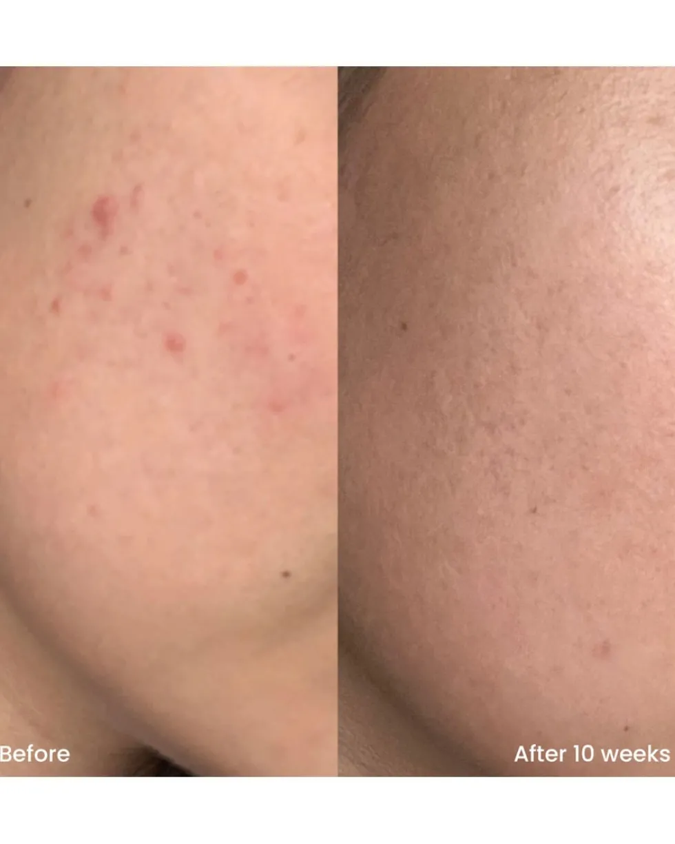 clay and glow triple aha face gel cleanser VERZACHTENDE REINIGINGSGEL