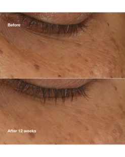 clinique all about eyes brightening serum concentrate Donkere kringen en wallen tegen gaan