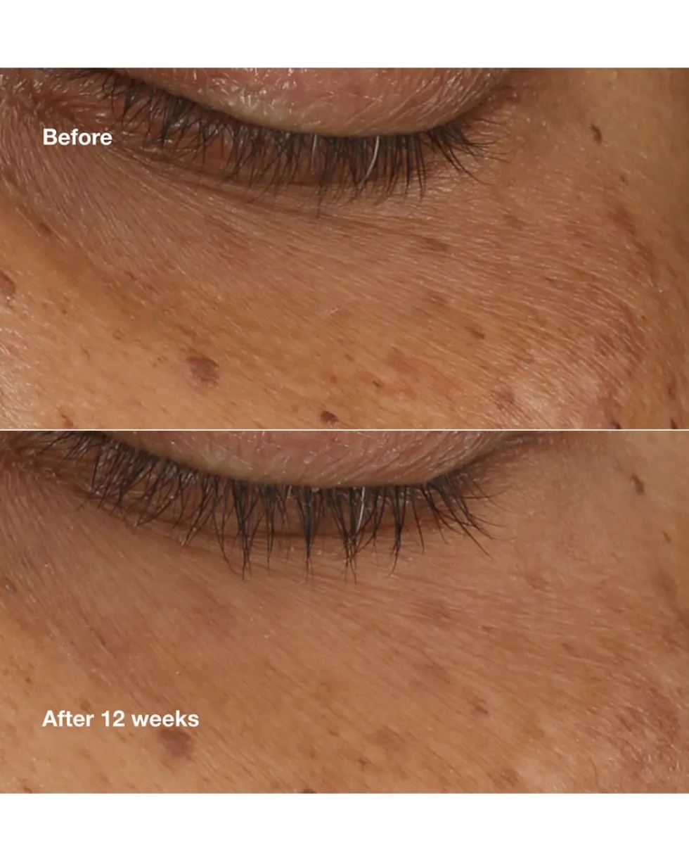 clinique all about eyes brightening serum concentrate Donkere kringen en wallen tegen gaan