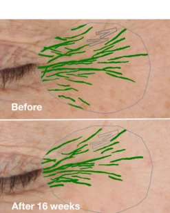 clinique clinique smart clinical repair™ wrinkle correcting cream ANTI-AGING HYDRATERENDE CRÈME - ALLE HUIDTYPES