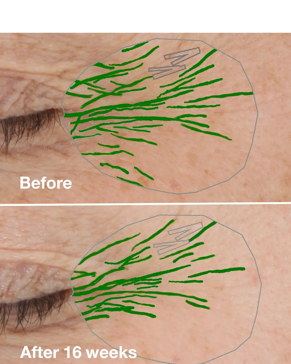 clinique clinique smart clinical repair™ wrinkle correcting rich cream ANTI-AGING HYDRATERENDE CRÈME - DROGE HUID