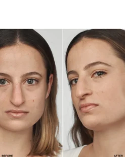 clinique even better™ clinical serum foundation HYDRATERENDE & EGALISERENDE FOUNDATION SPF 20 - 24U LANGHOUDEND & WATERPROOF