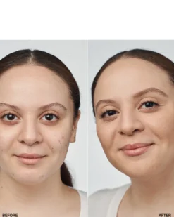 clinique even better™ clinical serum foundation HYDRATERENDE & EGALISERENDE FOUNDATION SPF 20 - 24U LANGHOUDEND & WATERPROOF