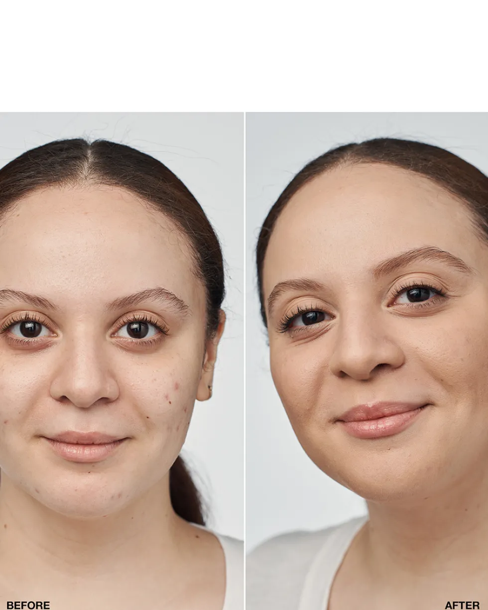 clinique even better™ clinical serum foundation HYDRATERENDE & EGALISERENDE FOUNDATION SPF 20 - 24U LANGHOUDEND & WATERPROOF