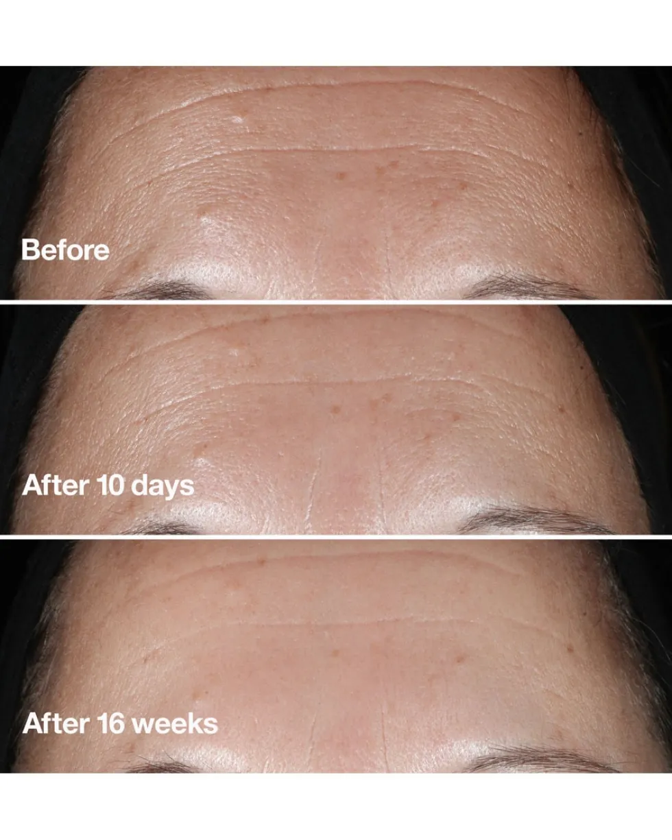 clinique smart clinical Anti-Wrinkle Correcting Serum
