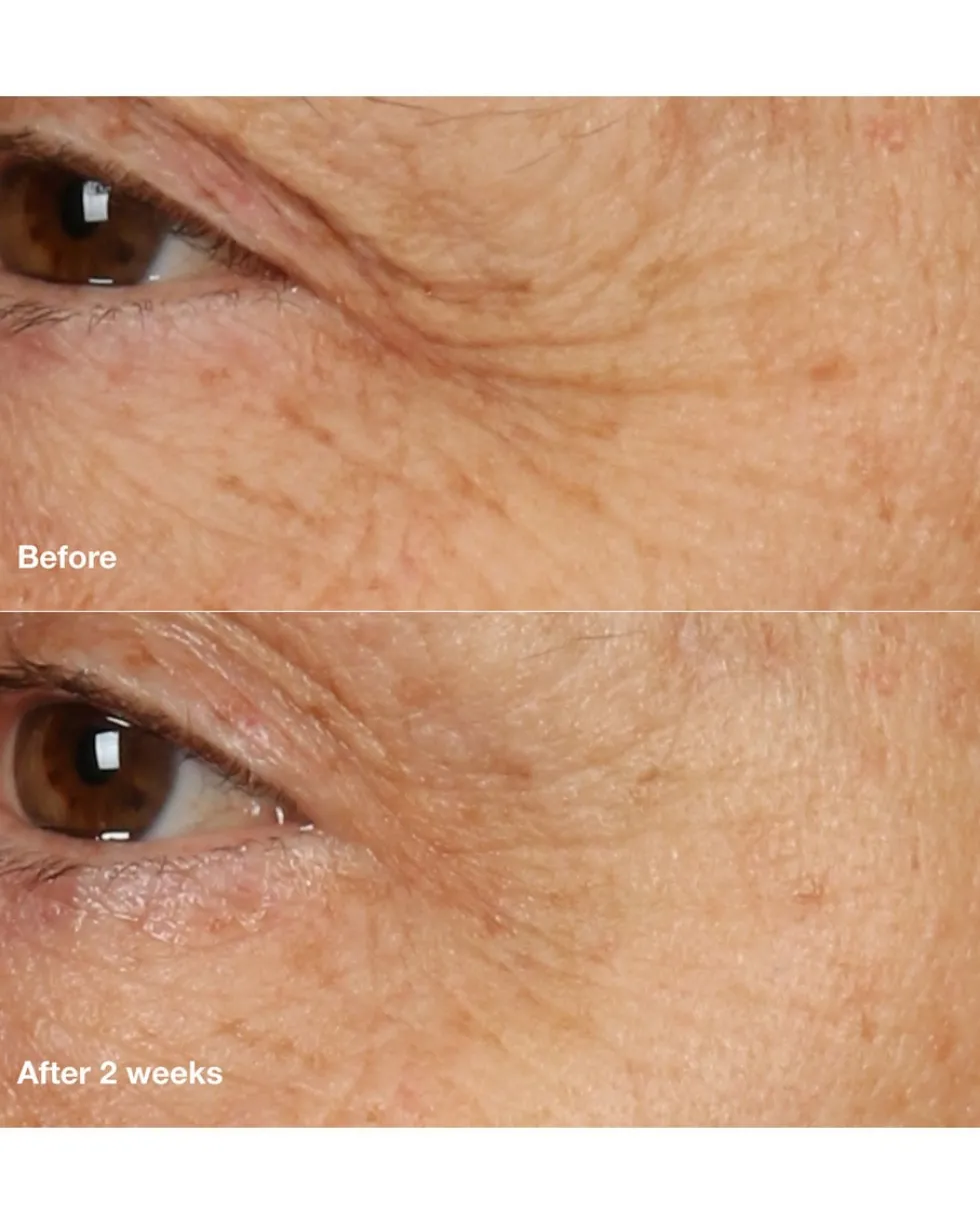 clinique smart clinical repair™ overnight recovery cream + mask Anti-aging crème