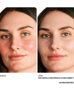 erborian centella red serum Onmiddellijk kalmerend concentraat