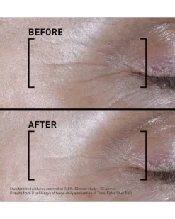 filorga SHOT 5XP Geconcentreerd serum - Correctie van zichtbare expressierimpels