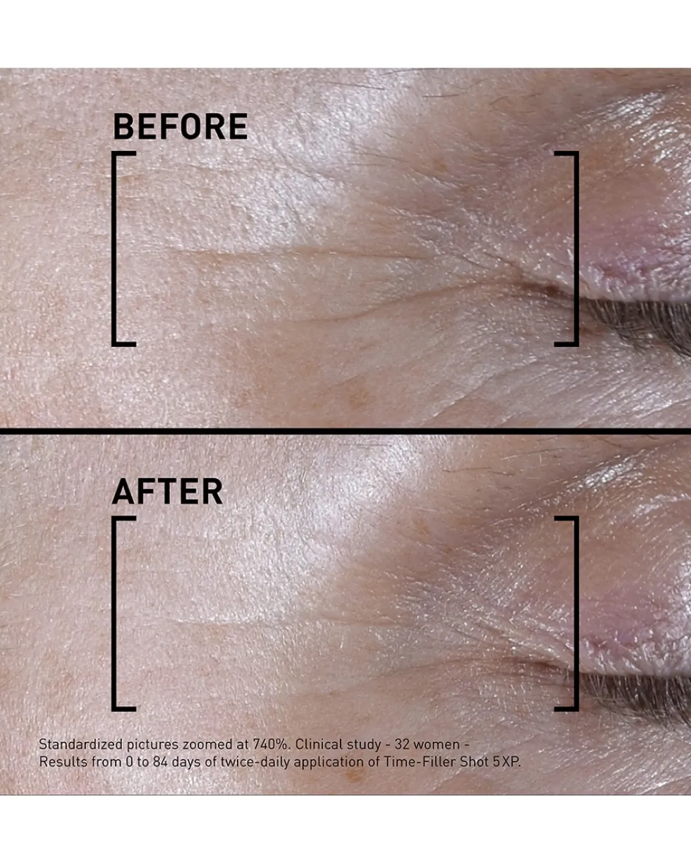 filorga SHOT 5XP Geconcentreerd serum - Correctie van zichtbare expressierimpels
