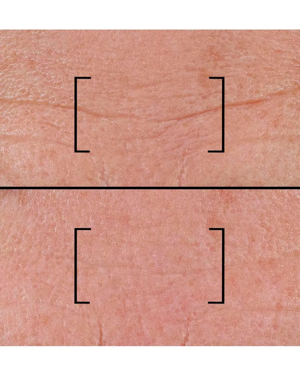 filorga time-filler Serum