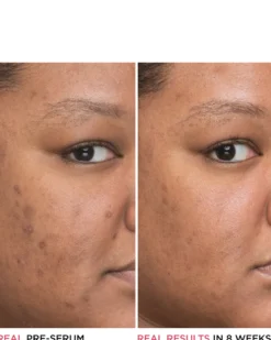 it cosmetics bye bye serum IT BYE BYE DARK SPOTS NIACINAMIDE SERUM