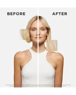 kérastase première sérum filler fondamental Herstellend haarserum voor beschadigd haar