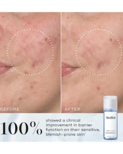 medik8 press and clear Exfoliating 2% BHA Tonic Gentle-Release Salicylic Acid
