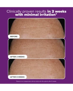 paula's choice clinical CLINICAL Pro Retinaldehyde Dual-Retinoid Treatment