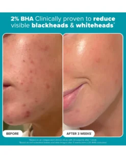 paula's choice mini-kit Multi-Level Exfoliatie