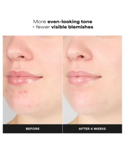 paula's choice sking perfecting 1% BHA Gentle Exfoliating Gel Toner