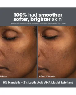 paula's choice skin perfecting SKIN PERFECTING 6% Mandelic Acid + 2% Lactic Acid AHA Liquid Exfoliant
