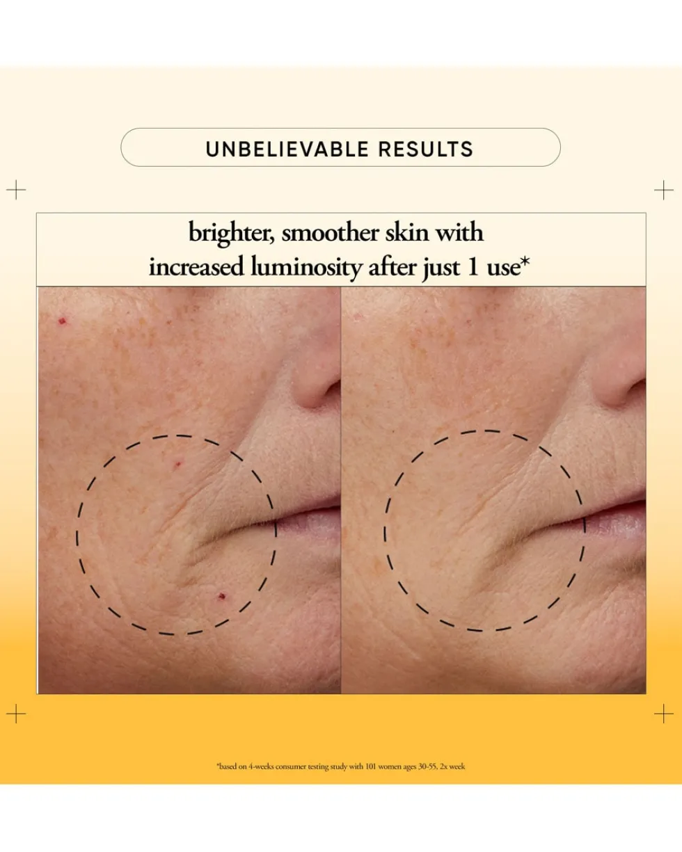 philosophy the microdelivery Vitamin c resurfacing peel kit