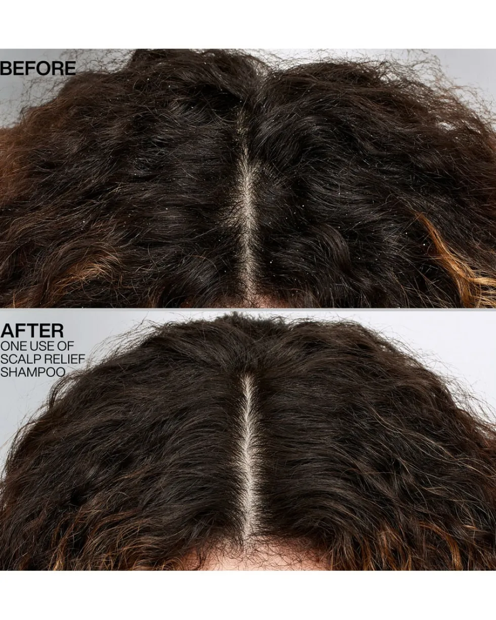 redken scalp relief Dandruff shampoo - voor droog haar & een gevoelige hoofdhuid