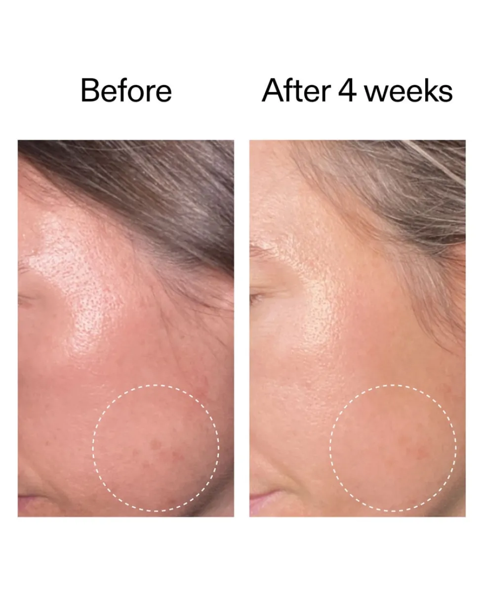 the inkey list advanced retinal serum Geavanceerd Retinal Serum