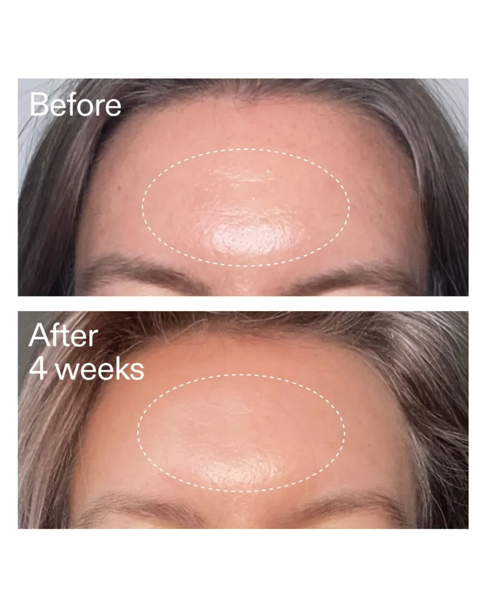 the inkey list advanced retinal serum Geavanceerd Retinal Serum