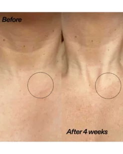 the inkey list bio-active ceramide neck stick Nek Stick
