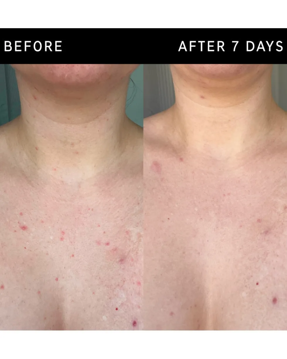 the inkey list body care Exfoliërende bodystick met glycolzuur