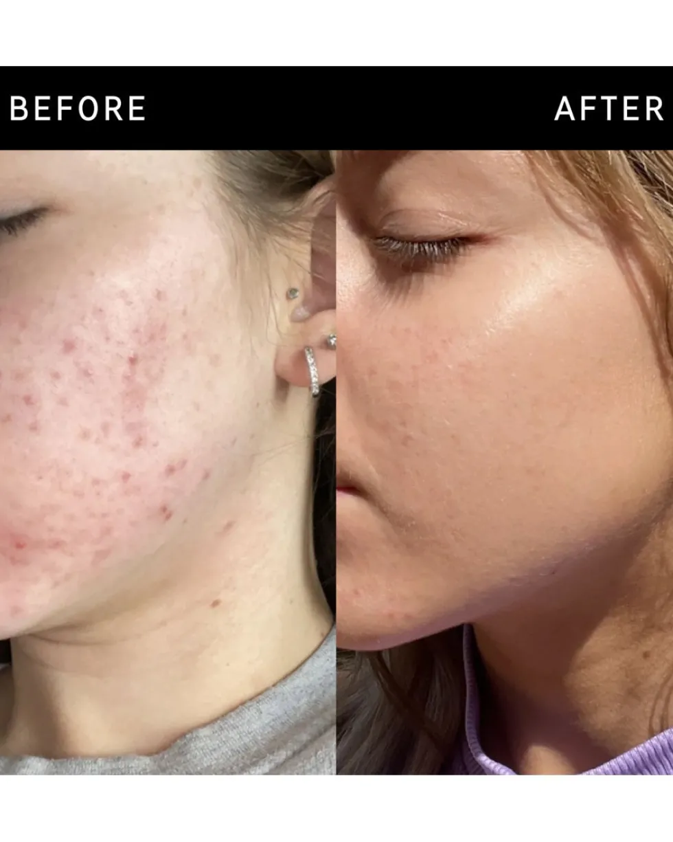 the inkey list niacinamide serum NIACINAMIDE SERUM