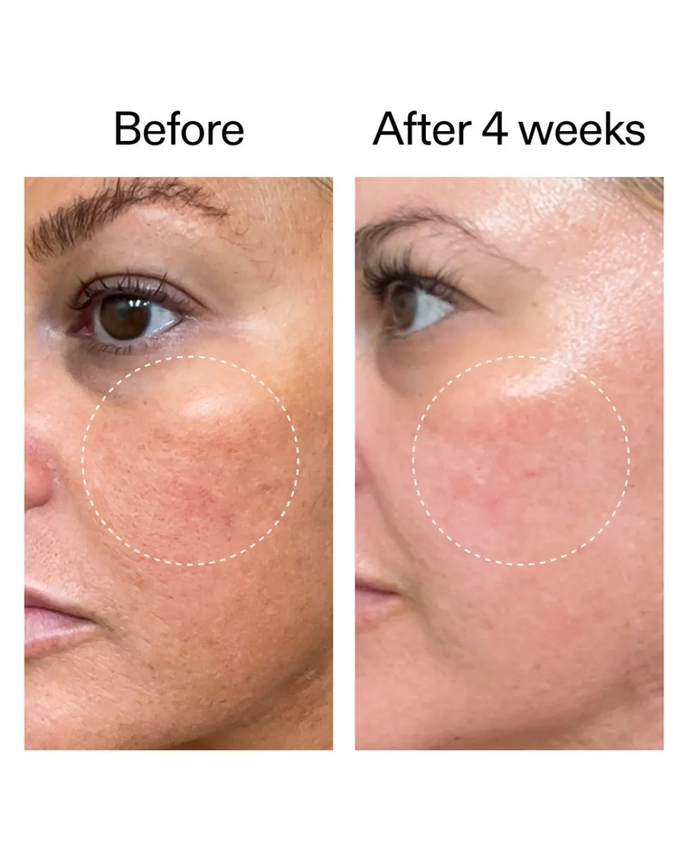 the inkey list starter retinol serum Retinol Serum voor Beginners