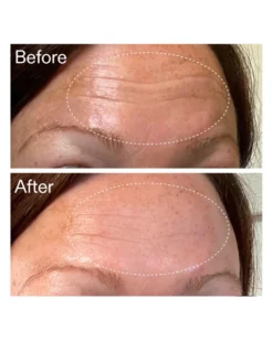 the inkey list starter retinol serum Retinol Serum voor Beginners