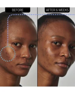 the inkey list supersolutions SUPERSOLUTIONS 20% NIACINAMIDE SERUM
