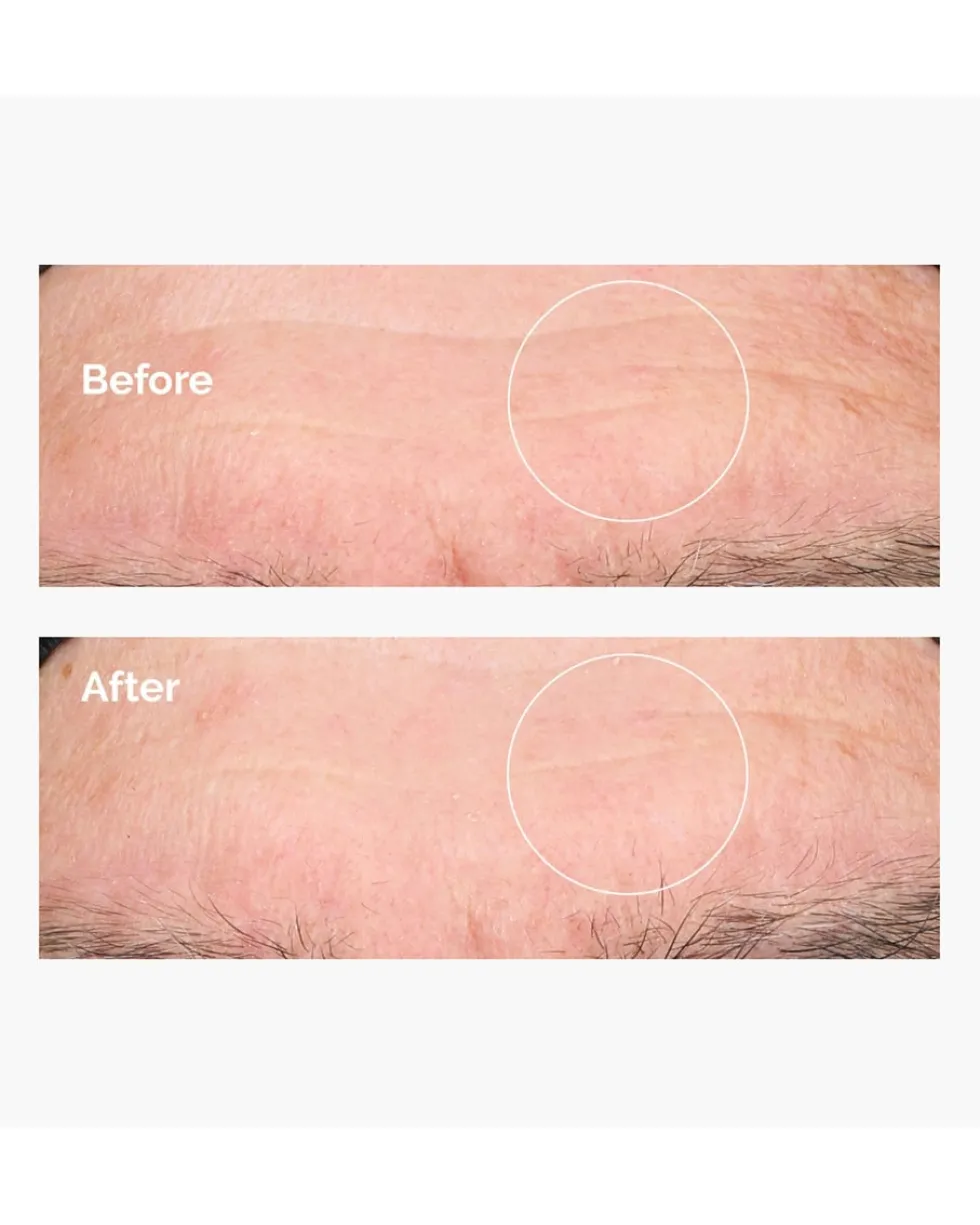 the ordinary dryness & dehydratation Hyaluronic Acid 2% + B5