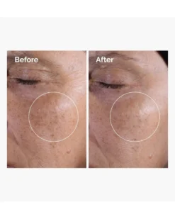 the ordinary toner Glycolic Acid 7% Exfoliating Toner