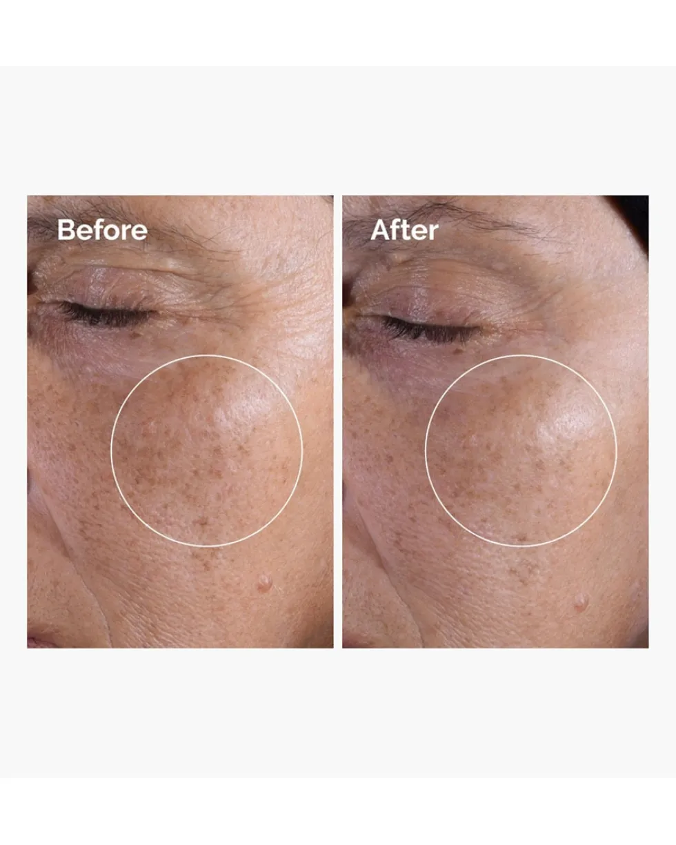 the ordinary toner Glycolic Acid 7% Exfoliating Toner